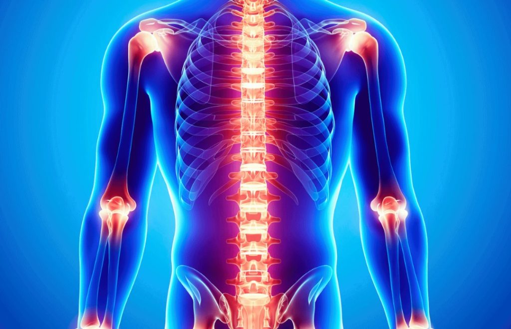 Chronic Joint & Spinal Pain